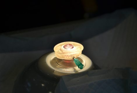 PHACOEMULSIFICATION BASIC Kurs, April 2025